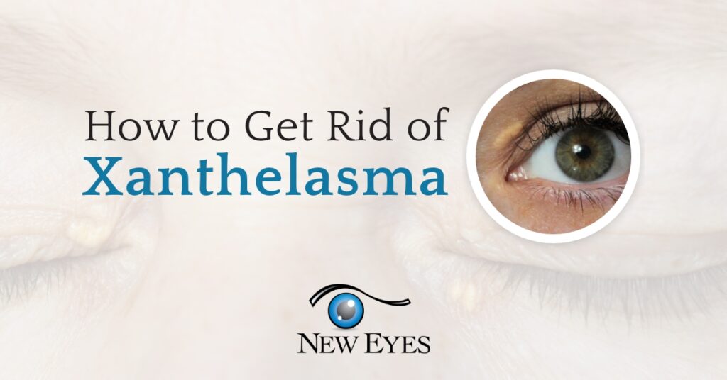 how-to-get-rid-of-xanthelasma